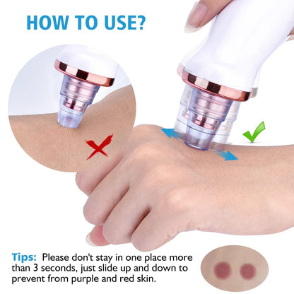 5 in 1 Blackhead remover | Derma Suction | Rechargeable |