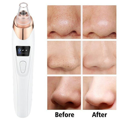5 in 1 Blackhead remover | Derma Suction | Rechargeable |